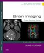 Brain Imaging: Case Review Series E-Book - Preview