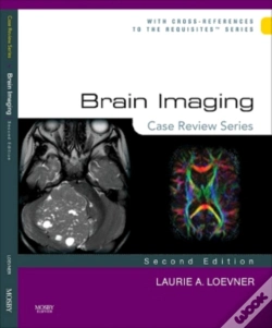 Capa do artigo Brain Imaging: Case Review Series E-Book
