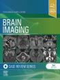 Brain Imaging: Case Review Series E-Book - Preview
