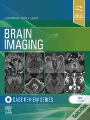 Capa do artigo Brain Imaging: Case Review Series E-Book