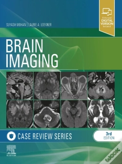 Capa do artigo Brain Imaging: Case Review Series E-Book