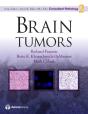 Brain Tumors - Preview