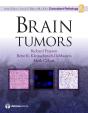 Brain Tumors - Preview