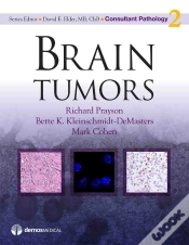 Capa do artigo Brain Tumors