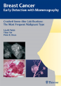 Breast Cancer: Early Detection With Mammography - Preview