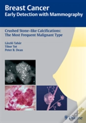 Capa do artigo Breast Cancer: Early Detection With Mammography