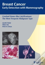 Capa do artigo Breast Cancer: Early Detection With Mammography