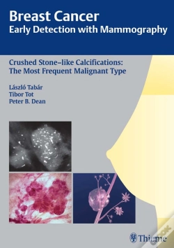 Capa do artigo Breast Cancer: Early Detection With Mammography