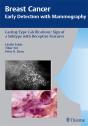 Breast Cancer: Early Detection With Mammography - Preview