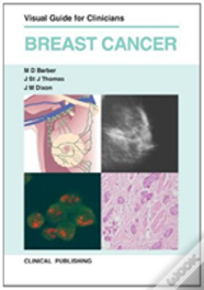 Breast Cancer