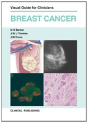 Breast Cancer - Preview