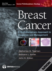 Capa do artigo Breast Cancer