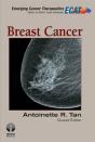 Breast Cancer - Preview