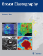 Breast Elastography - Preview