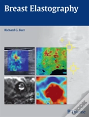 Capa do artigo Breast Elastography