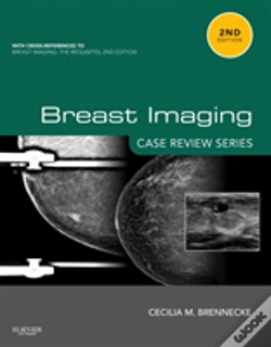 Capa do artigo Breast Imaging