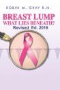 Breast Lump What Lies Beneath? - Preview