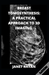 Breast Tomosynthesis