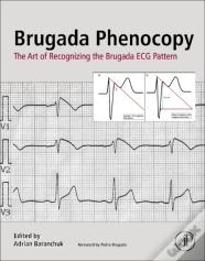 Brugada Phenocopy