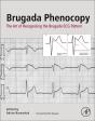 Brugada Phenocopy - Preview