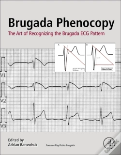 Capa do artigo Brugada Phenocopy