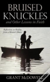Bruised Knuckles And Other Lessons In Faith