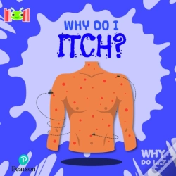 Capa do artigo Bug Club Reading Corner: Age 5-7: Why Do I Itch?