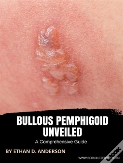 Capa do artigo Bullous Pemphigoid Unveiled