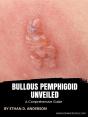 Bullous Pemphigoid Unveiled - Preview