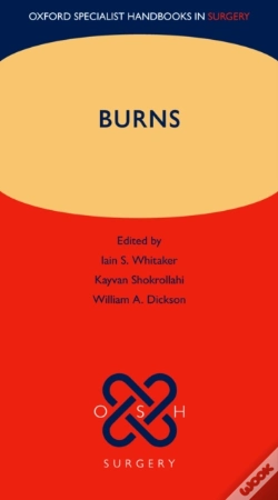 Capa do artigo Burns