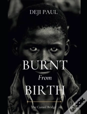 Capa do artigo Burnt From Birth