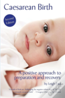 Caesarean Birth