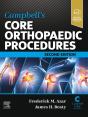 Campbell'S Core Orthopaedic Procedures E-Book - Preview
