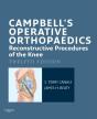 Campbell'S Operative Orthopaedics: Reconstructive Procedures Of The Knee E-Book - Preview