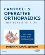 Campbell'S Operative Orthopaedics - Preview