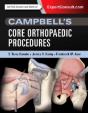 Campbell'S Top 100 Orthopaedic Procedures - Preview