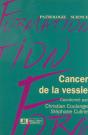 Cancer De La Vessie - Preview