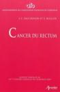 Cancer Du Rectum - Preview