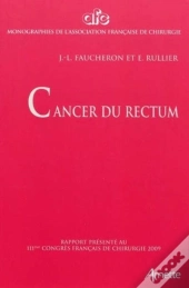 Cancer Du Rectum