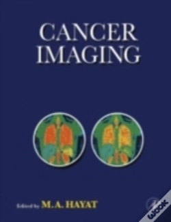 Capa do artigo Cancer Imaging