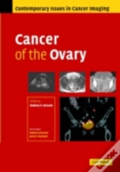 Capa do artigo Cancer Of The Ovary
