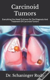 Capa do artigo Carcinoid Tumors