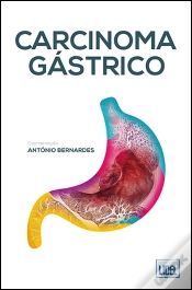 Capa do artigo Carcinoma Gástrico