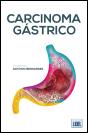 Carcinoma Gástrico - Preview