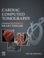Cardiac Computed Tomography -E-Book - Preview