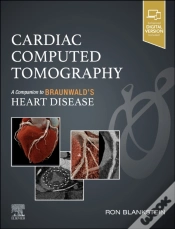 Capa do artigo Cardiac Computed Tomography