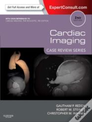 Cardiac Imaging