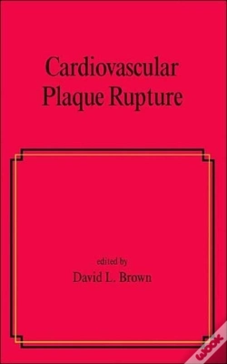 Capa do artigo Cardiovascular Plaque Rupture