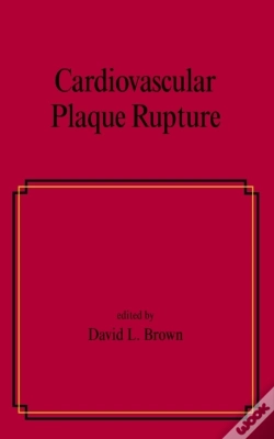 Capa do artigo Cardiovascular Plaque Rupture