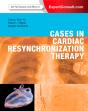 Cases In Cardiac Resynchronization Therapy E-Book - Preview